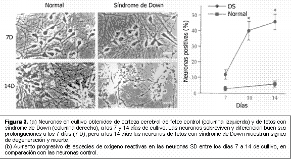 El envejecimiento de las personas con síndrome de Down