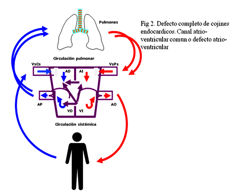 Canal atrioventicular. Canal atrioventicular.