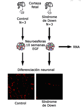 Las neuroesferas obtenidas a partir de tejido cerebral con síndrome de Down