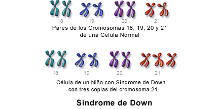 Cromosoma 21.